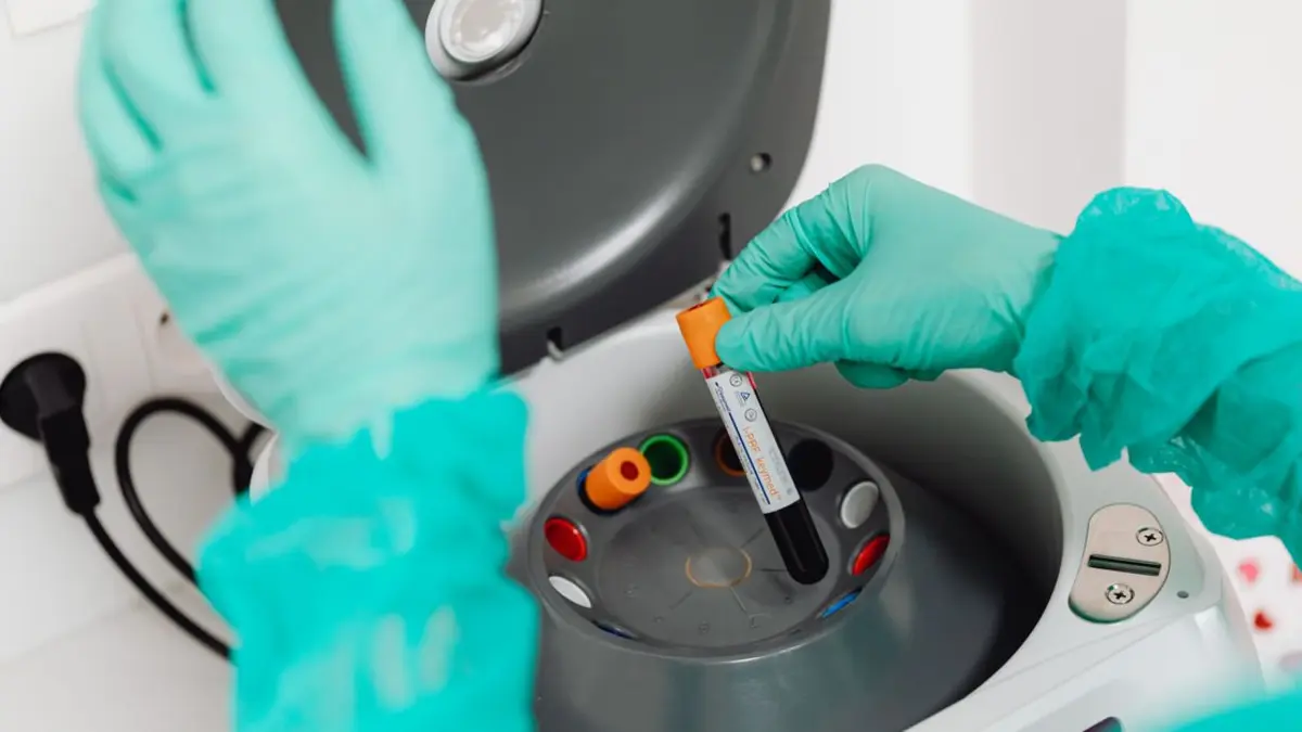 Molecular sieve beads darkened by H2S exposure in a sour gas dehydration tower